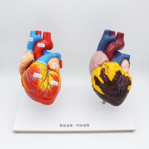 정상심장과 흡연심장의 비교모형(심장비교모형)